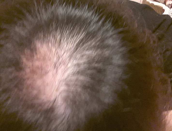 프로스카및 여러가지 영양제