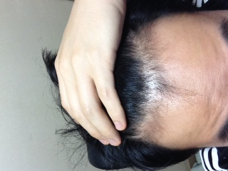 上传FFF约2年+AVO约3个月后记吧