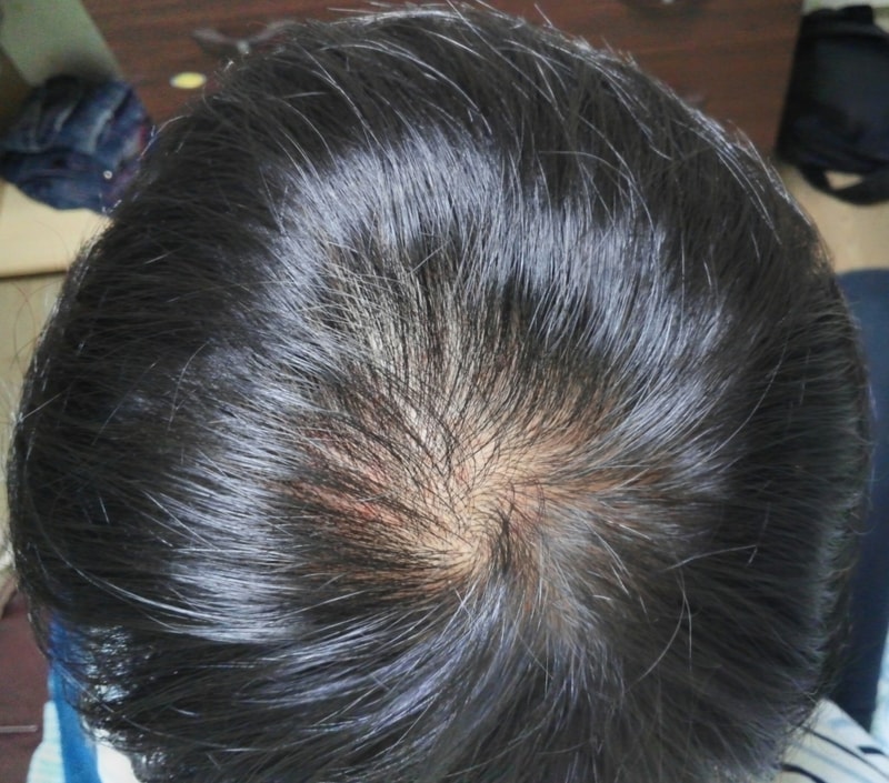 Monad Jung 5个月后期...