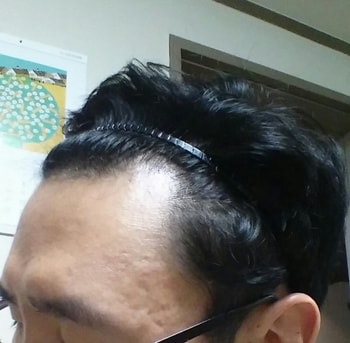 지금상태3