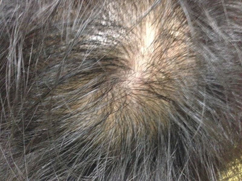 프로스카 어제부로 시작합니다