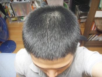 2012년 5월..  6개월차에 상당히 좋아졌었네요. 