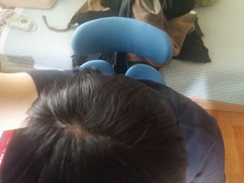 미녹시딜 3개월차