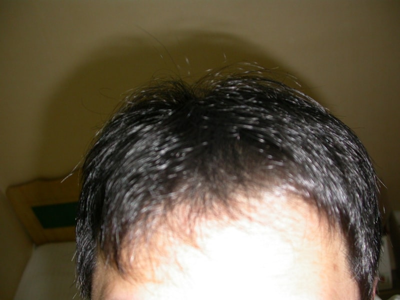 정말 오랜만에 글을 남기네요.(두타 2005년 1,2월 부터 현재까지...복용중)