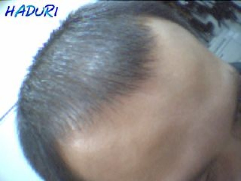 This is my hair! Mr. Riglo..