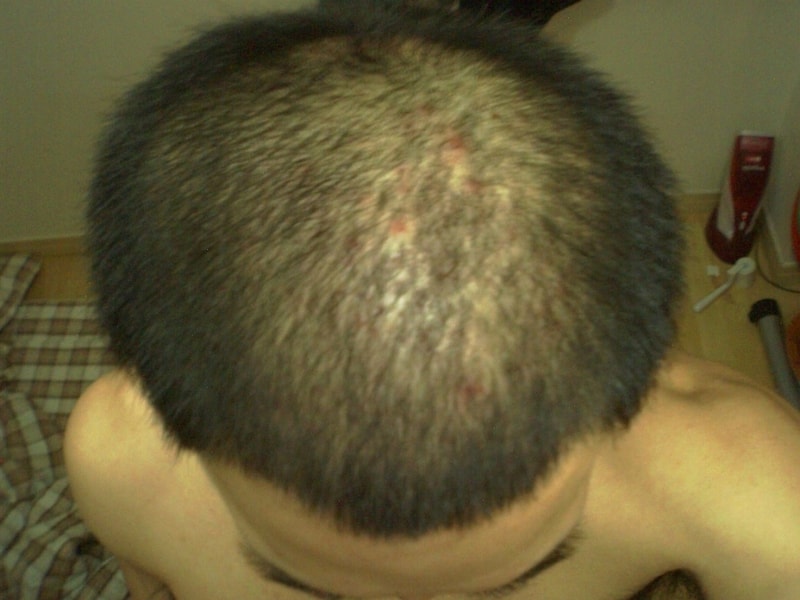 삭발했는데 그냥다녀도될거같은가요???