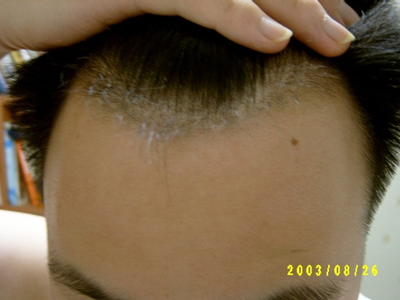 [re] 무진장 빠지네요..ㅎㅎ