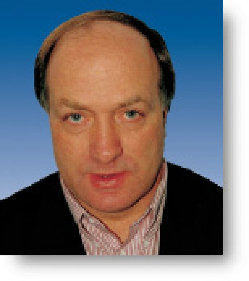 난 대머리가 싫다...정말정말 시러!!!