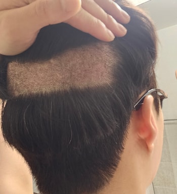 후두부