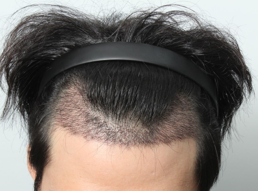 정면사진