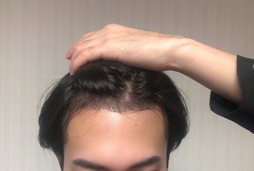 후~