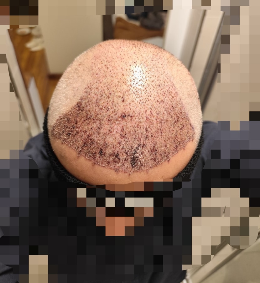 2일차