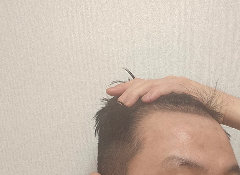 수술 전 사진