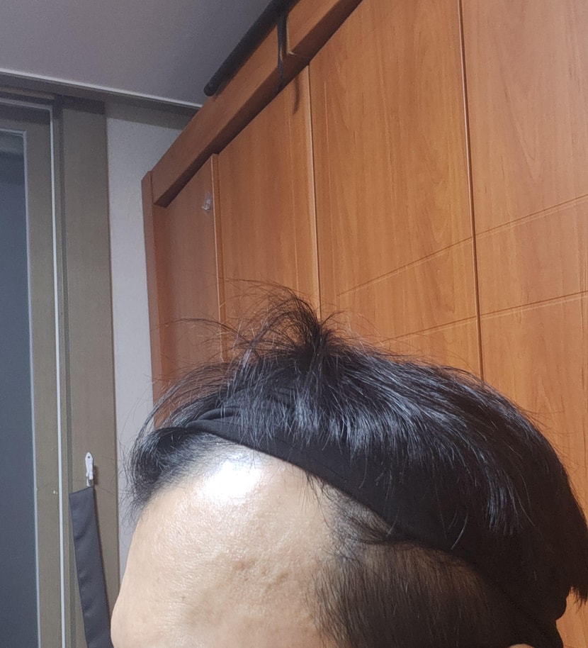 전