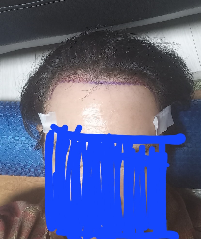 수술당일 