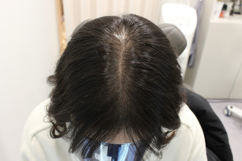 16일경과