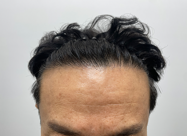 후