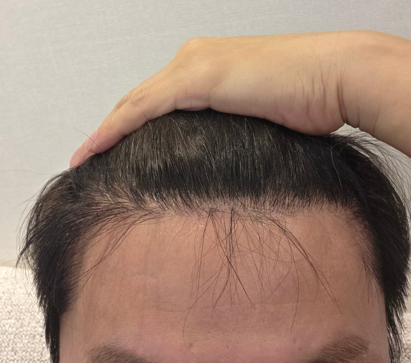 현재