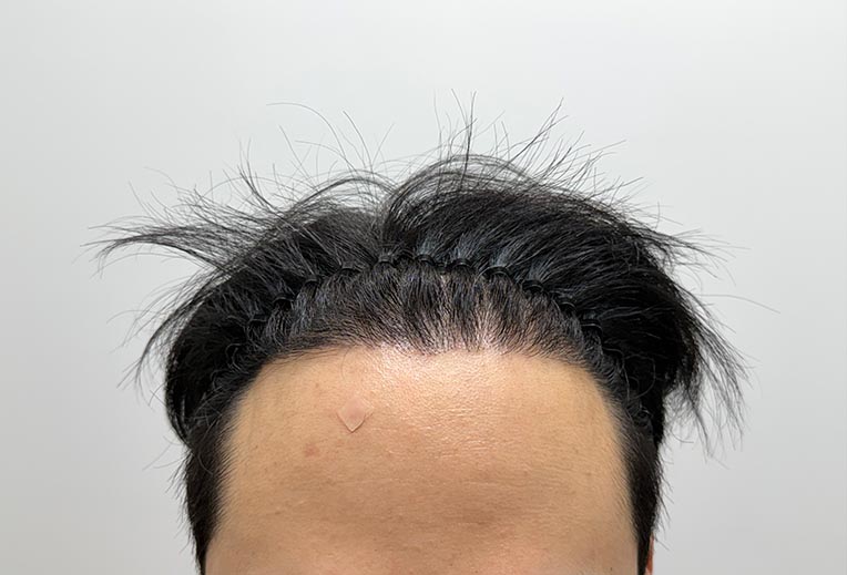 앞모습 후 사진