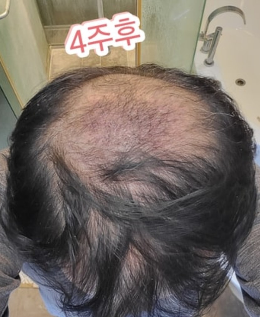 4주후