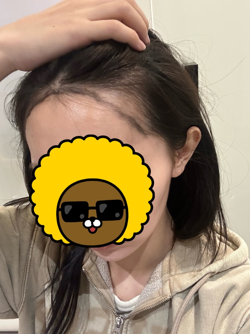 모모 3000모