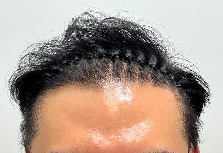 후