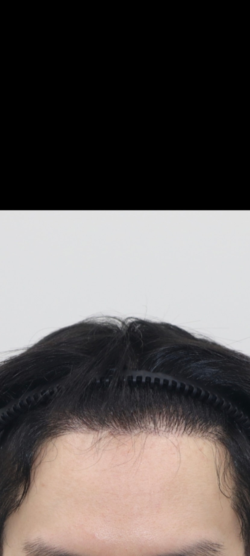 7개월 병원사진
