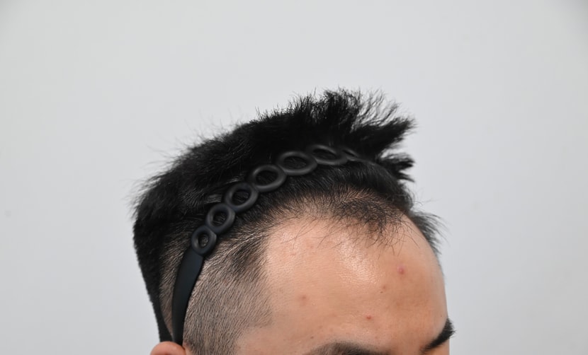 수술전1
