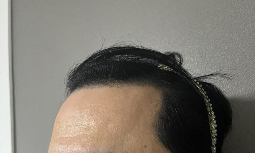전