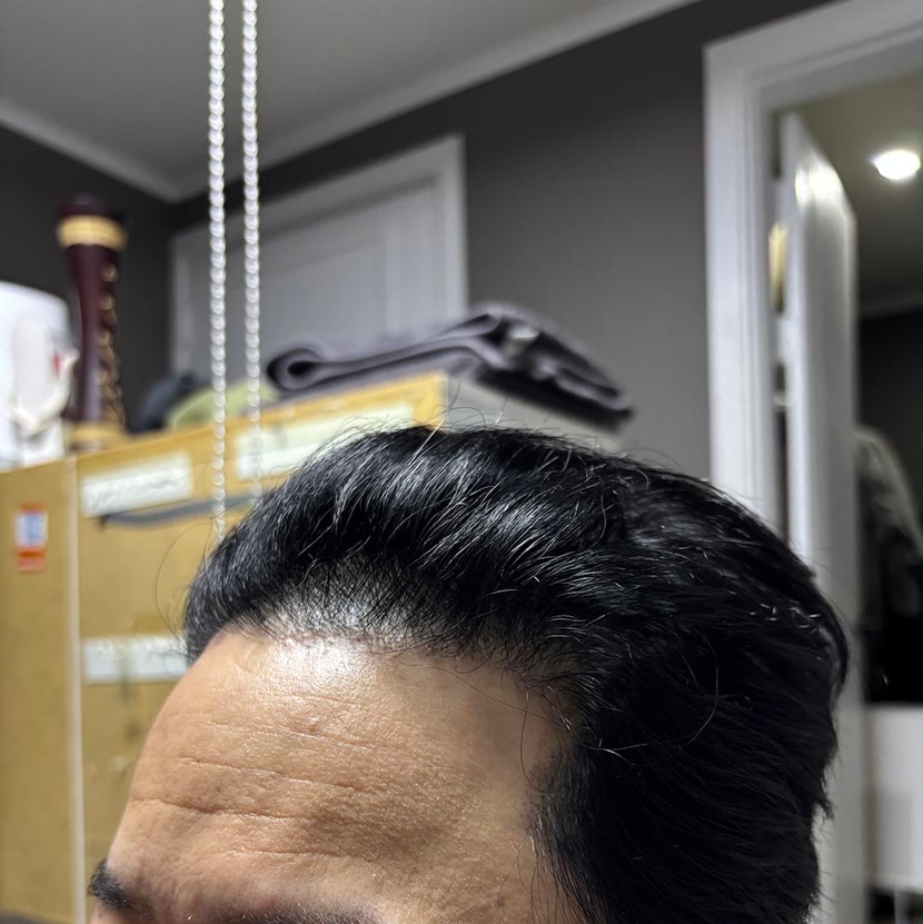 후