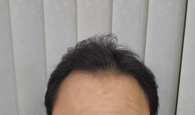 전