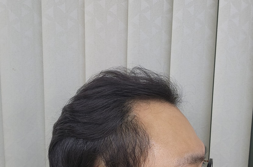 전