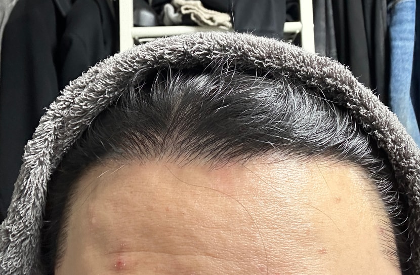 현재 8개월