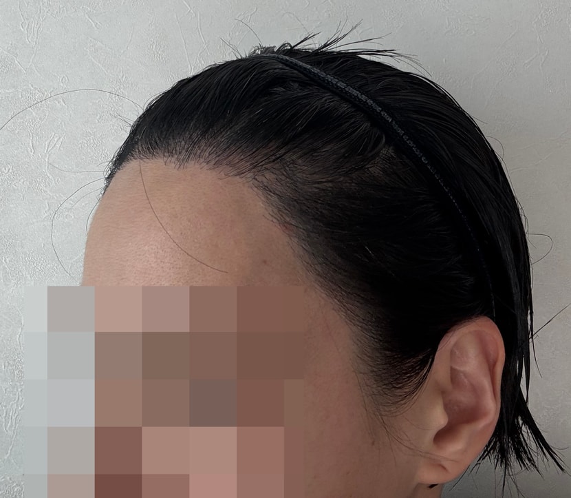 12개월