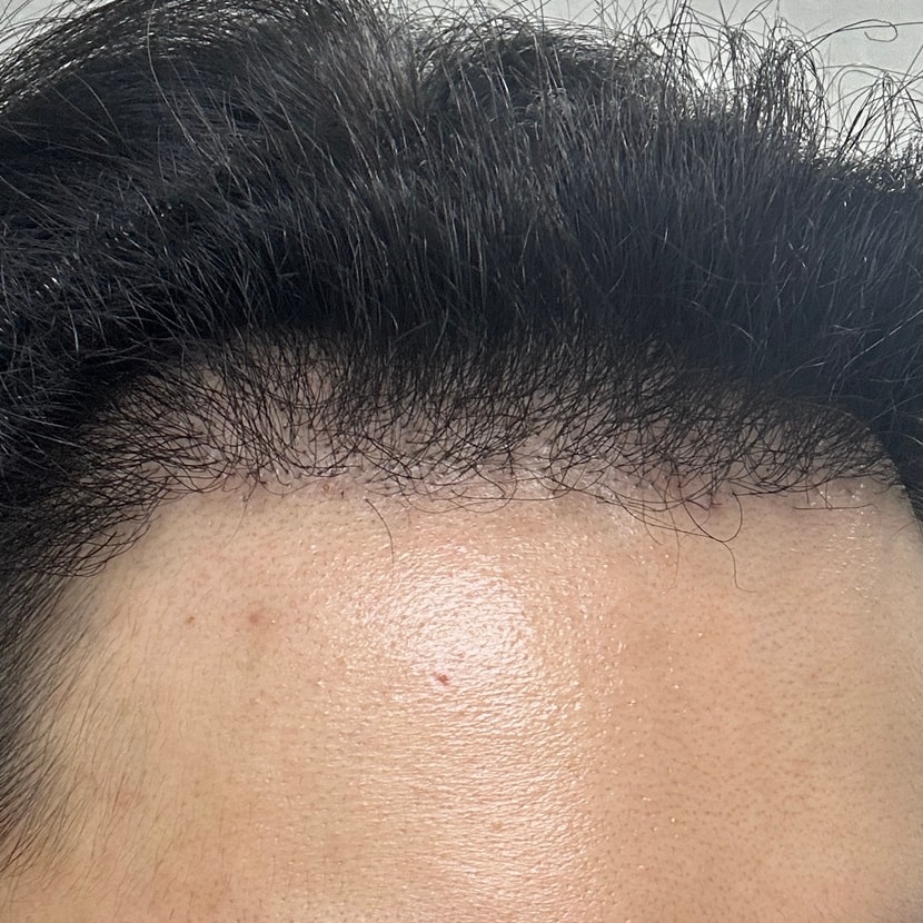 측면