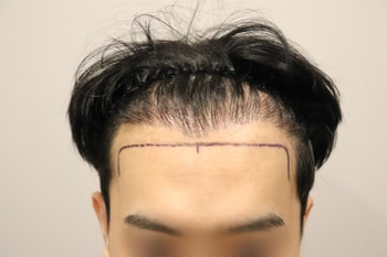 전