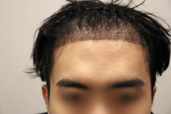 후