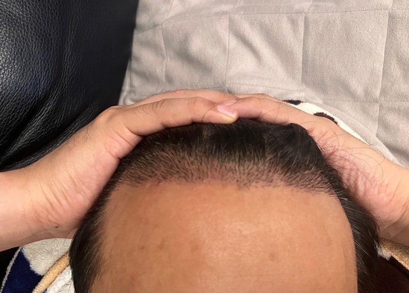 수술 10일차 