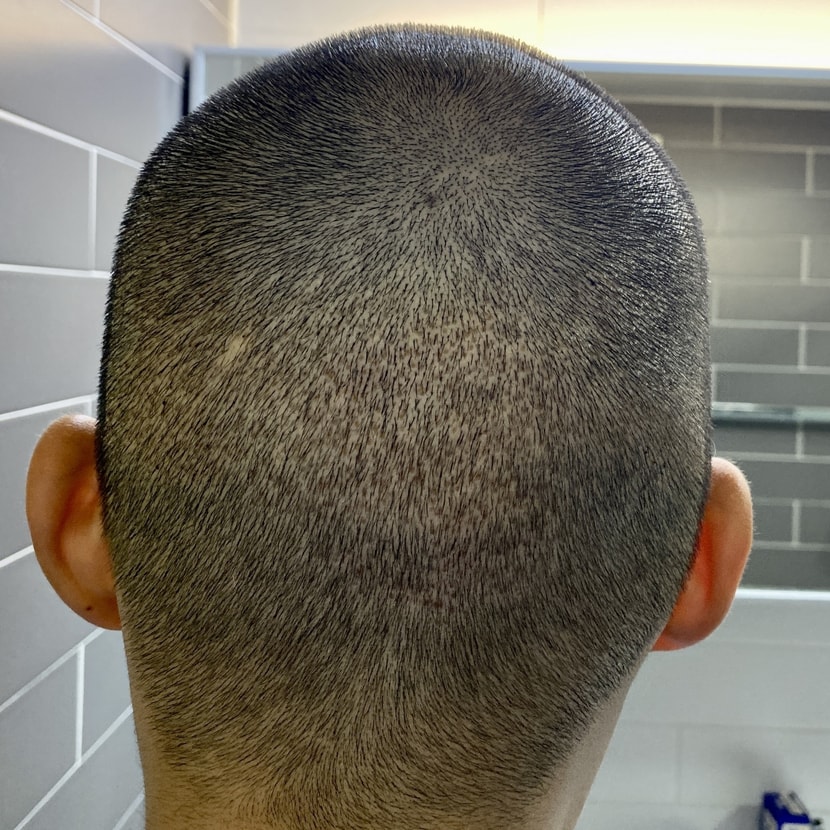8일차 뒷통수