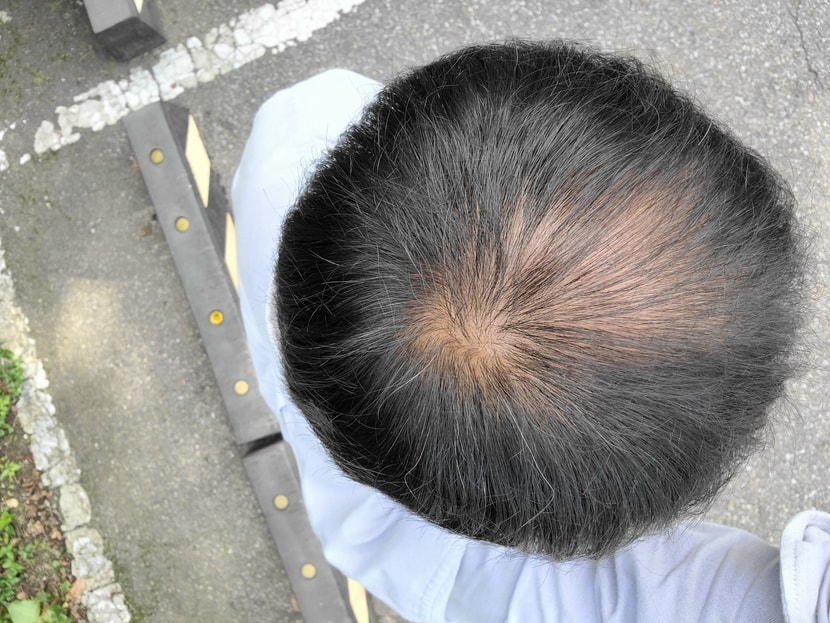 최근 3개월차
