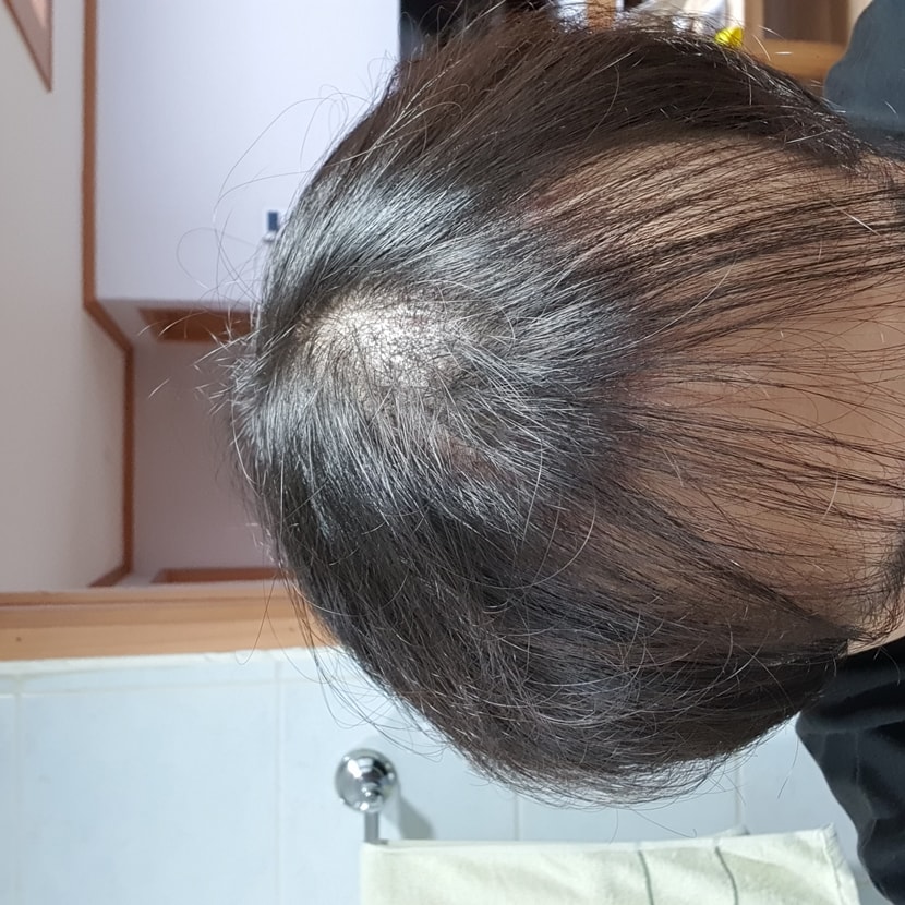 암흑기