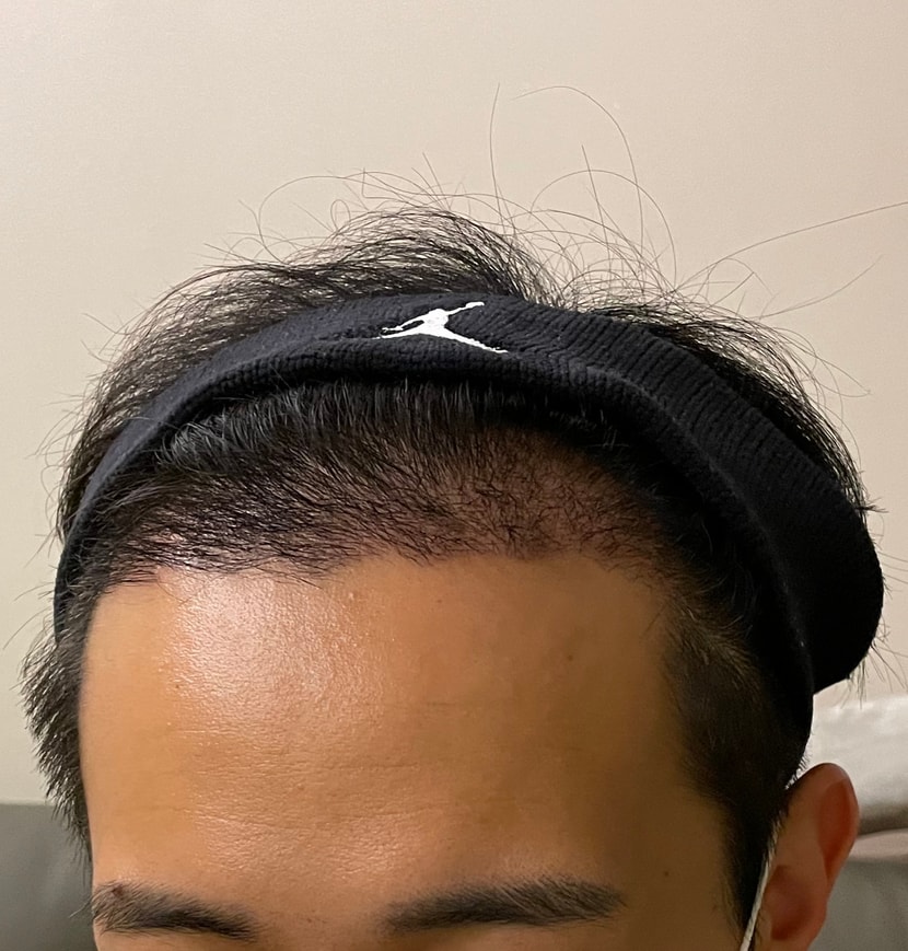 36일후(측면)