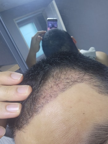 20일차 경과