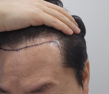 첫방문 상담때 찍은사진 
