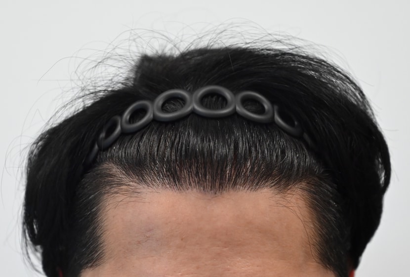 후