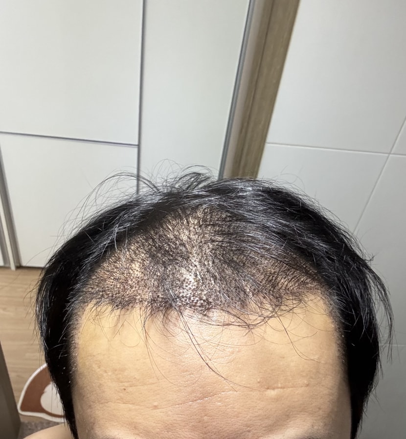 7일차