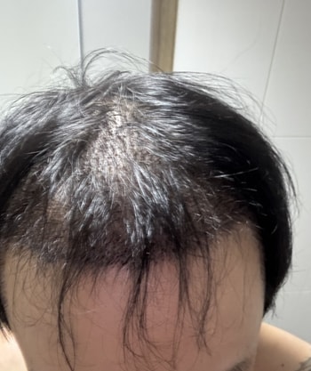 7일차