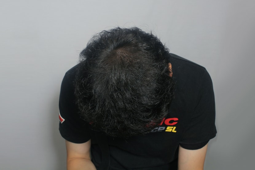 후