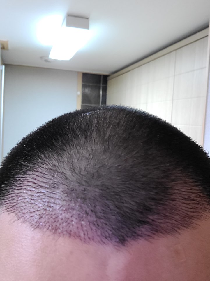2주