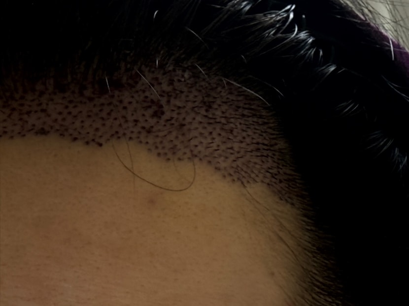 양옆